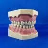 Model for Prosthetics and Conservative