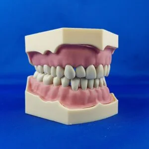 Model for Prosthetics and Conservative