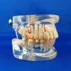 Transparent demonstrative pathological human mouth