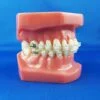 Human Mouth for Orthodontics