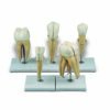 Five enlarged fundamental teeth, mounted on base