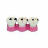 Caries Demonstration Teeth