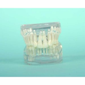 Class II Malocclusion – Division 2