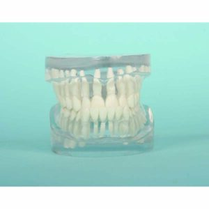 Class III Malocclusion