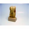 Enlarged Tooth Model