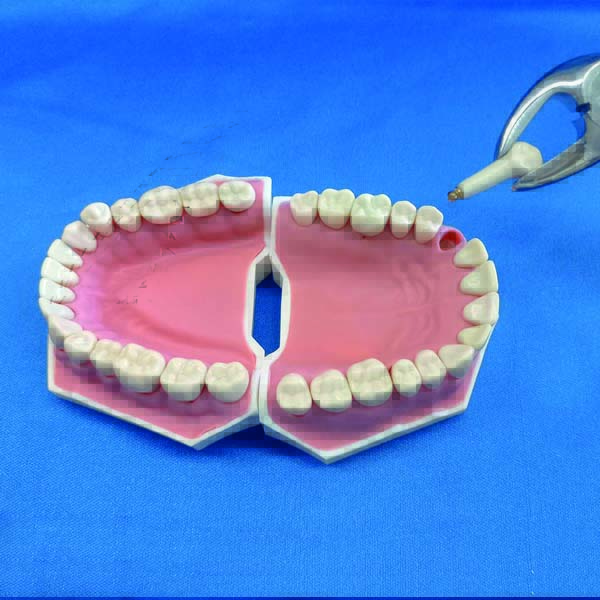 Modello completo superiore e inferiore a 32 denti per esercitazioni di protesi e conservativa con gengive in silicone iperplastico e sistema brevettato di estrazione dei denti extra duri con clip, attacco a manichino