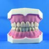 Model for prosthetic and conservative exercises with extra hard tooth extraction with clip