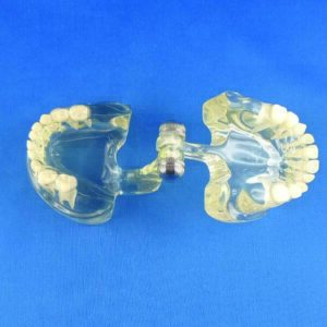 Modello trasparente dimostrativo 20 denti bambino completo di occlusore