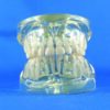 Transparent demonstrative model for children’s teeth