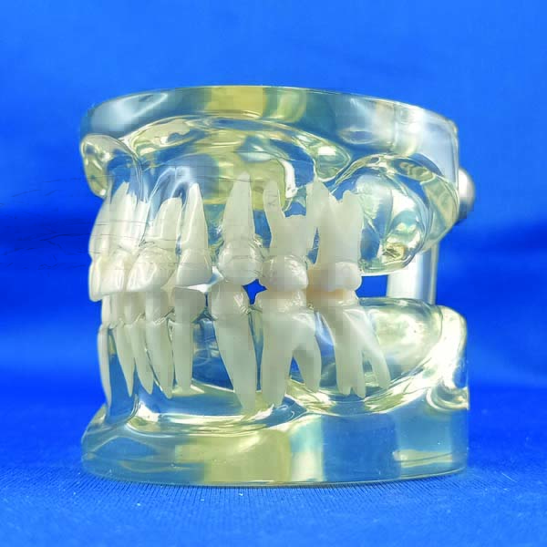 Modello trasparente dimostrativo 20 denti bambino completo di occlusore
